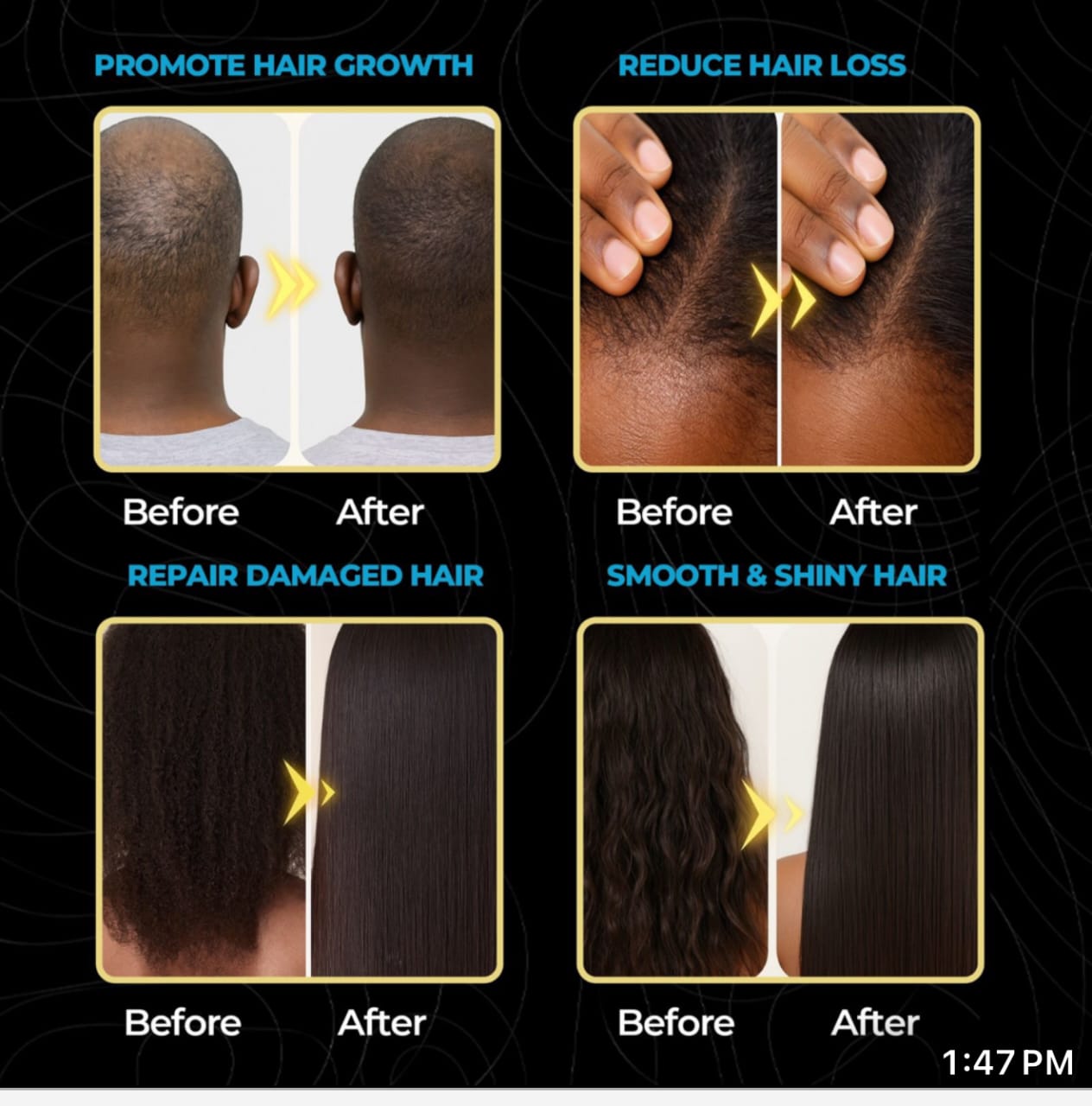 Anume Naturals 100% Pure Batana Oil